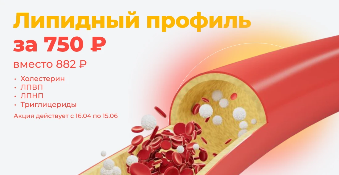 Липидный профиль